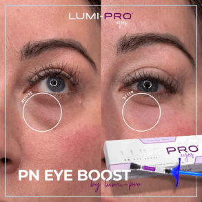 LUMI-Pro®  Eyes PN Eye (1x1ml)